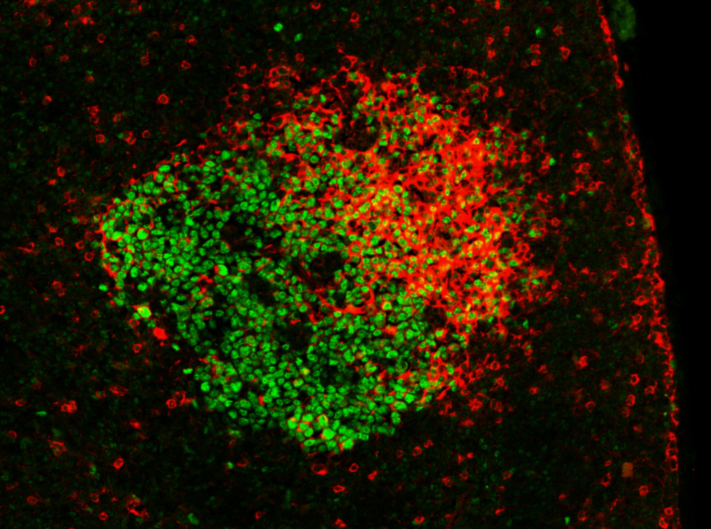Expertise Immunologie Intégrative des Lymphocytes B